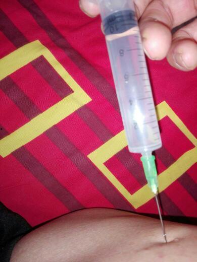 超痛打屁股针视频,揭秘针扎背后的恐惧与勇气